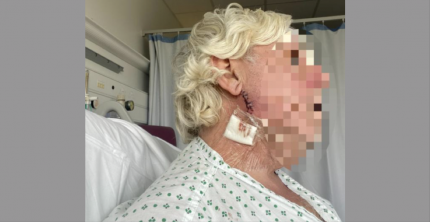 OXFORD MAN RISKS FACIAL PARALYSIS AFTER TAXI DRIVER ATTACKED HIM FOLLOWING DISPUTE
